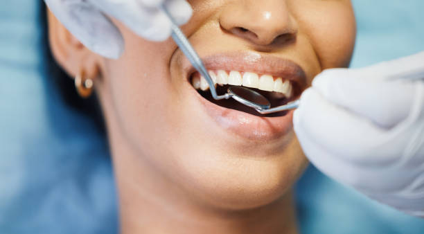 Best Emergency Dental Care for Sports Injuries in Springtown, TX