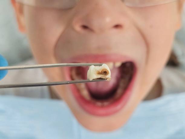 Best Weekend Emergency Dental Services in Springtown, TX